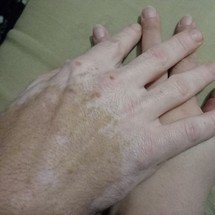 parejablanes2